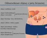Ilustracja przedstawia schemat jamy brzusznej z zaznaczonymi organami i punktami odpowiadającymi objawom chorobowym.