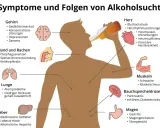 Illustration zeigt Symptome von Alkoholsucht: Gehirn, Herz, Lunge, Leber, Magen, Bauchspeicheldrüse, Muskeln, Mund & Rachen. Die 10 Stufen des Alkoholismus sind hier nicht dargestellt.