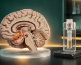 Sezione di cervello con segni di Alzheimer e provetta. Ricerca sui quali esami del sangue per Alzheimer.
