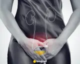 Ilustracja układu moczowego z zaznaczonymi nerkami i pęcherzem. Wskazuje na problem z odpływem moczu, sugerując potrzebę płukania nefrostomii.