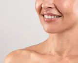 Sorriso radioso con labbra lucide e denti bianchi. La pelle del collo mostra le delicate "collane di Venere", segni di bellezza naturale.