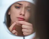 Kobieta z pryszczem na brodzie ogląda się w lustrze i dotyka go palcem.