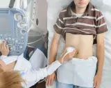 Lekarz wykonuje USG jamy brzusznej, aby przeprowadzić test na zapalenie wyrostka robaczkowego.