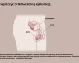 Ilustracja układu rozrodczego męskiego, omawiająca metody leczenia problemów z wytryskiem, w tym zmniejszenie wrażliwości penisa.