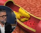 Mężczyzna w okularach opowiada o tym, jak wyleczył miażdżycę, podczas gdy na ekranie widać przekrój tętnicy z cholesterolem i czerwonymi krwinkami.