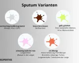 Sputum-Varianten: verschiedene Schleim-Farben bei Erkrankungen wie Asthma, COPD oder Infektionen.