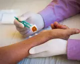 Ręce w rękawiczkach przygotowują wacik do dezynfekcji skóry przed zabiegiem. Przestrzeganie zasad dezynfekcji jest kluczowe.