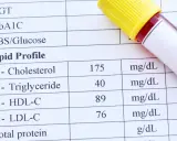 Fragment analizy lipidowej z wynikami cholesterolu, trójglicerydów, HDL-C i LDL-C oraz probówką krwi.