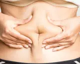Liposukcja brzucha: Koszt, czynniki i jak uniknąć niespodzianek