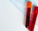 Dwie probówki z krwią na tle maseczki medycznej. Czy to badanie egfr?