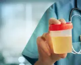Lekarz pokazuje pojemnik z moczem, badanie na obecność leukocyty w moczu w ciąży jest kluczowe dla zdrowia.