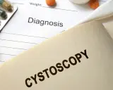 Na dokumentach medycznych, obok leków i termometru, widnieje napis "CYSTOSCOPY". Czas trwania cystoskopii jest kluczowy dla pacjenta.