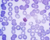 Microscopic view of red blood cells with a malaria parasite.