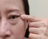 Un doigt tire la peau sous l'œil, révélant les poches sous les yeux et les rides.