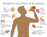 Ilustracja pokazuje, że alkohol to trucizna, która wpływa na mózg, serce, płuca, wątrobę, trzustkę i żołądek, powodując różne schorzenia.