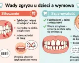 Stłoczenie zębów i szparowatość mogą leczyć wady wymowy. Ilustracja pokazuje problemy z zębami i ich wpływ na mowę.