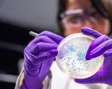 Naukowczyni w fioletowych rękawiczkach bada szalkę Petriego z koloniami bakterii, w tym escherichia coli, pod mikroskopem.