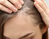 Delikatne baby hair przy linii czoła, widoczne na zbliżeniu.