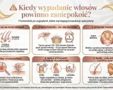 Nadmierne wypadanie włosów, przerzedzenie, swędzenie skóry głowy, łamliwe pasma – to sygnały, od czego wypadają włosy i kiedy warto skonsultować się ze specjalistą.