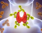 Tarczyca atakowana przez żółte przeciwciała, ilustracja chorób autoimmunologicznych. W tle brązowe przeciwciała.