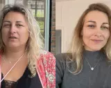 Avant/après : le visage s'affine visiblement après une perte de poids. La question "à partir de combien de kilos perd on du visage" trouve ici une réponse visuelle.
