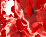 Podwyższona hemoglobina: Kiedy martwić się wynikiem badań?