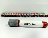 Probówka z oznaczeniem "OGTT - Test" na tle wielu innych próbek krwi. To ważny etap w diagnostyce cukrzycy, czyli test obciążenia glukozą.