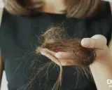 Une femme de 40 ans examine une poignée de cheveux tombés, signe de perte de cheveux.