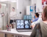 Medico mostra scansioni cerebrali, discutendo le possibili memoria a breve termine cause con un paziente.
