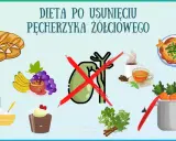 Zdrowe jedzenie po usunięciu woreczka żółciowego: pieczywo, owoce, nabiał, ryba, warzywa. Unikaj kawy i słodkości.