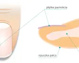 Przekrój palca z widoczną płytką paznokcia i opuszkiem. Paznokieć to wytwór naskórka chroniący paliczek.