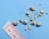 Kamienie w moczowodzie objawy: drobne, nieregularne kamienie na niebieskim tle, obok fragmentu miarki.