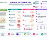La esponja anticonceptiva es un método de barrera suave y flexible que se coloca en la vagina para prevenir embarazos.