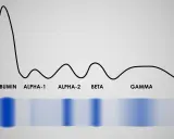 Wykres elektroforezy białek surowicy, pokazujący normę. Widoczne pasma albumin, alfa-1, alfa-2, beta i gamma.