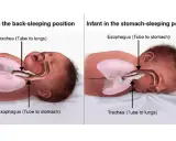 Illustrazione anatomica che mostra come far addormentare un neonato in posizione supina, con trachea e esofago liberi.