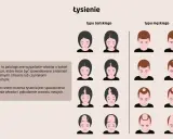 Ilustracja pokazuje różne etapy łysienia androgenowego u kobiet i mężczyzn. Widać stopniową utratę włosów, od przerzedzenia po całkowite wyłysienie.