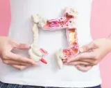 Model jelita grubego z widocznym polipem jelita grubego 3 cm. Dłonie trzymają model, podkreślając jego szczegóły.
