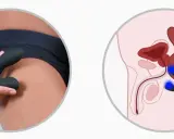 Dłoń trzyma czarny masażer, a obok schemat anatomiczny pokazujący stymulację prostaty.