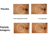 Porównanie skóry przed i po 12 tygodniach: placebo vs. peptydy kolagenu.