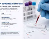 Blutstropfen fallen auf CRP-Testkassette. Ein hoher CRP-Wert im Blut zeigt Entzündungen an. Schnelle Ergebnisse für bessere Entscheidungen.