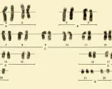 Cariotipo masculino con cromosomas ordenados por tamaño y forma, incluyendo los cromosomas sexuales X e Y.