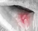 Afta i dentysta: Kiedy wizyta jest konieczna, a kiedy poczekać?
