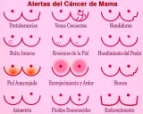 Síntomas cáncer de mama: ¿Qué señales no debes ignorar?