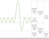 Diagramm zeigt Lungenvolumina, wie Tidalvolumen, Inspiratorisches Reservevolumen und Residualvolumen (RV).