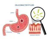 Ilustracja anatomiczna żołądka z wrzodami i bakteriami Helicobacter pylori pod lupą.