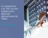 Médico revisa TACs cerebrales. La resonancia o TAC no detectan TDAH. Descubre qué puede estudiar un adolescente con TDAH.