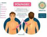 Ilustracja przedstawia objawy półpaśca, w tym ból, pieczenie i wysypkę na ciele, wskazując na nietypowe objawy półpaśca.