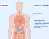 Anatomia człowieka z zaznaczoną trzustką. Ból trzustki może być odczuwany jako intensywny ból brzucha promieniujący do pleców.