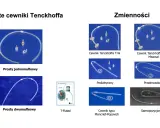 Różne rodzaje dializ: cewniki Tenckhoffa proste (jednomufkowe, dwumufkowe) i zmienne (T-W, pediatryczny, przedmostkowy, Moncrief-Popovich, samopozycjonujący).