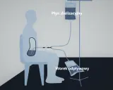 Schemat dializy otrzewnowej: cewnik Tenckhoffa w jamie otrzewnej pacjenta, podłączony do worka z płynem dializacyjnym i worka odpływowego.